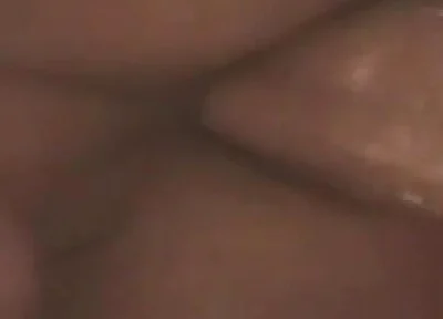 Gaping Anal Prolapse Overflow - Rosebud Pulsing Wide Open