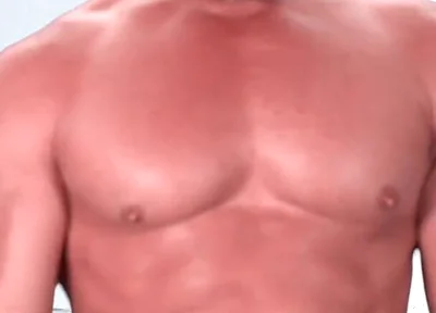 Be My Dental Patient and Pretend to Be Kyle