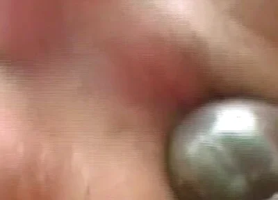 Gaping Anal Rosebud Prolapsing After Deep Stretching Session