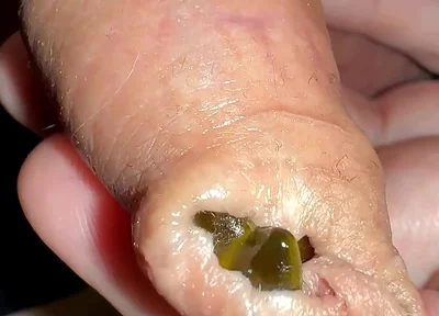 Juicy Small Cock Foreskin Games