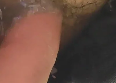 Uncircumcised Phimosis Has the First Ejaculation.