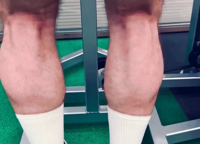 My Legs