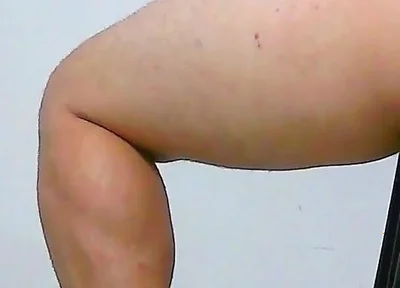 Oh, My Ass Hurts, Apply Ointment