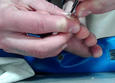 My Feet Stink and My Nails