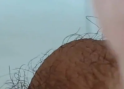Extreme Open Hole Leaves the Glans Exposed.