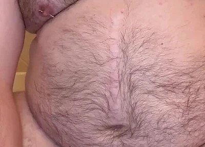 Pierced Chubby Guy Sounding with 3mm - 4mm and 5mm - 6mm Hegar