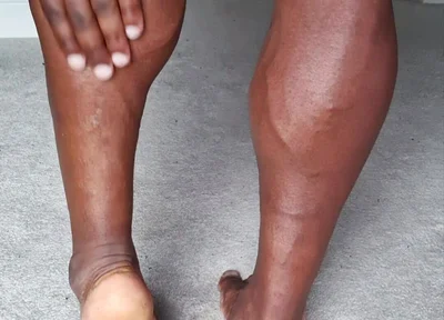 For My Feet Lovers