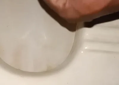 Urinating From the Penis