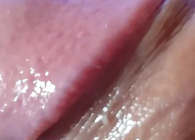 Strange Lumpy Cock with a Gigantic Head.
