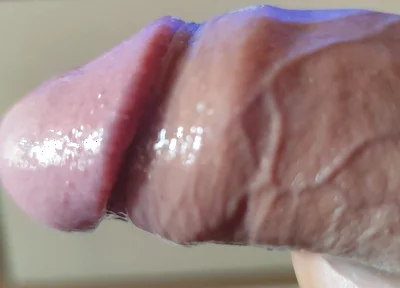 Strange Lumpy Cock with a Gigantic Head.