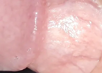 Incredible Cock, Unique of Slippery Phimosis by the Robust Body.