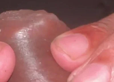 Forskin Play & My Thick Veiny Cock Shooting a Massive Creamy Load