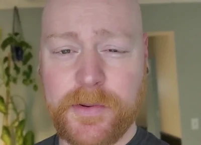 And as Always, It'll Grow Back