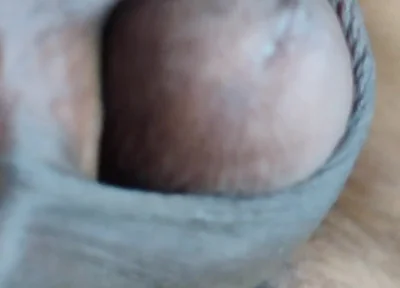 My Penis