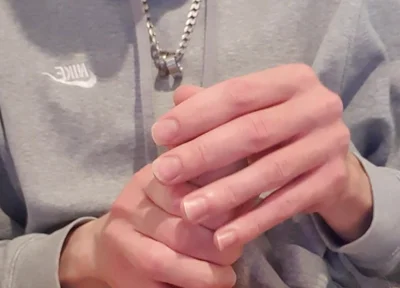 Skinny Lad Pulls Back Skin to Show Bellend