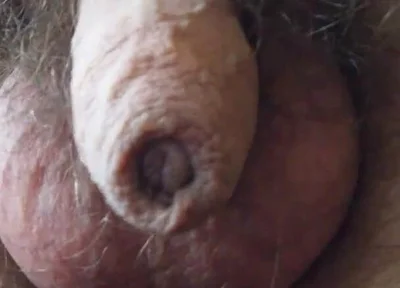 My Penis Walkabout