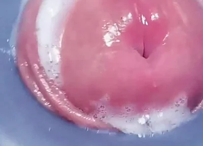 Penis Machine with a New Attachment