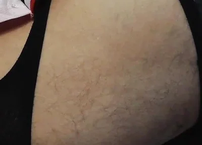 Rot Couch