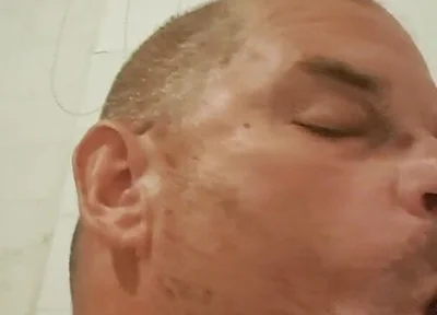 The Greedy Sucking