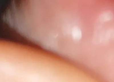 Hot Daddy in Close-up of the Inside of the Glans!