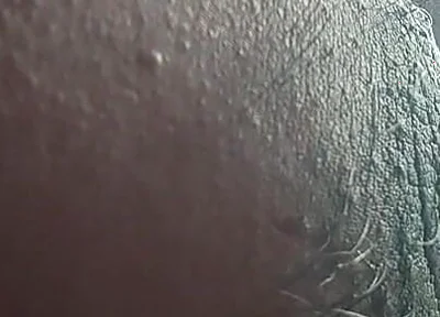 Armpit