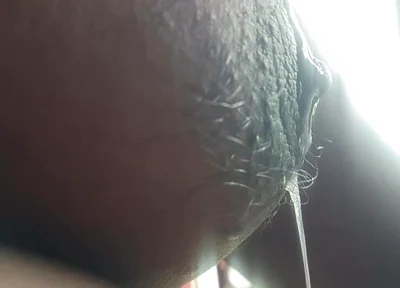 Armpit