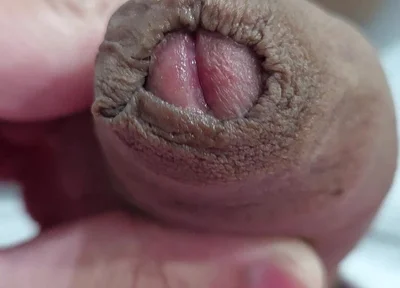 The Head of My Penis