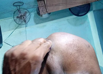 Anal sex