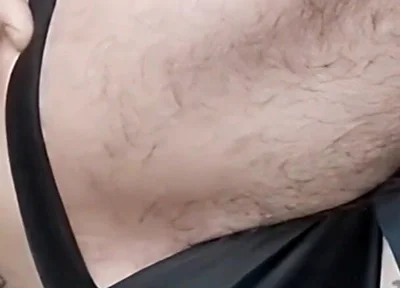 A Sperm Injection