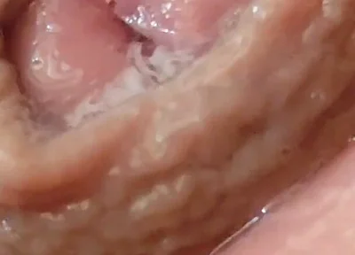 Juice From the Glans When Excited to the Extreme.