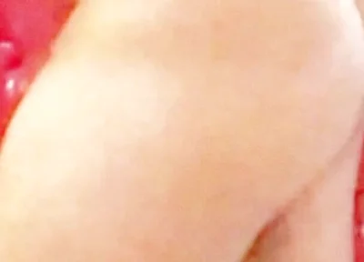Whip-lash