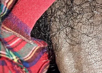 Close up on These Thick Veins