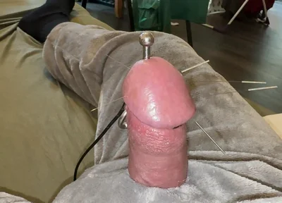 Acorn Acupuncture in a Cozy Cuddly Suit! Lots of Sperm!