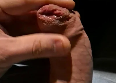 Leaking Precum From My Tight Foreskin
