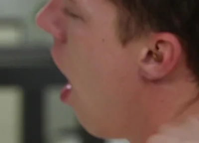 Exposed