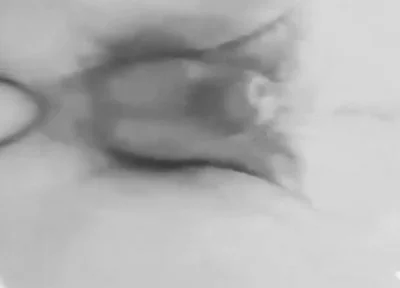 Anal Plaisure