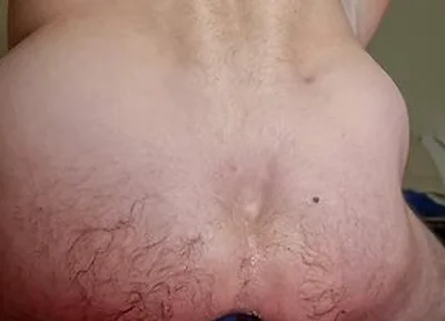 Extreme Anal Stretching With My Huge Blue Egg Plug