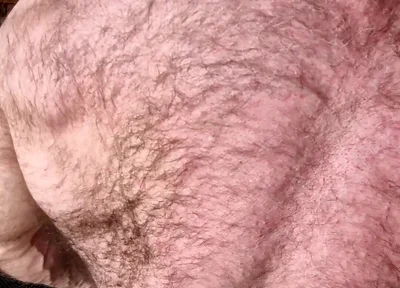 Hairy Muscle Back