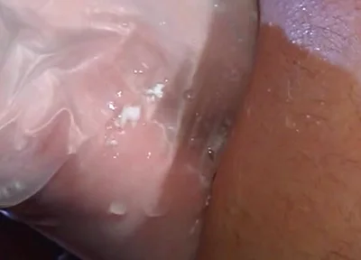 Butt out
