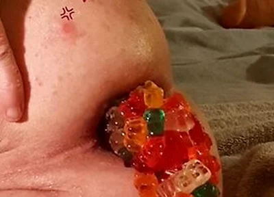 Big Load Of Gummy Bears Anal Stuffing And Expulsion Whit Prolapse