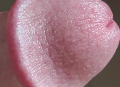 Closeup of Penis with One Vein