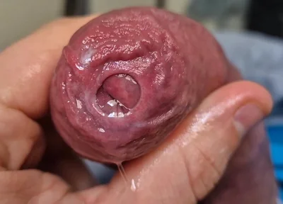 Uncut Head Precum Play