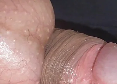 Amazing Upright Rough Venous Frenulum.