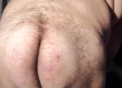 Fat Obese Butt
