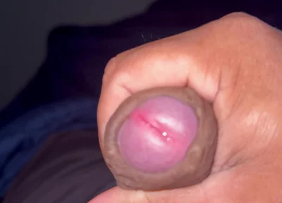 My Penis