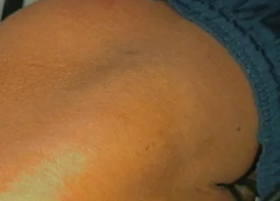 Curvy Ass