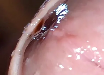 Glans Eye Watering After Intense Fucking.