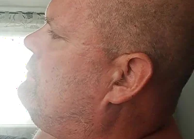 Renewed Destruction of the Bitch