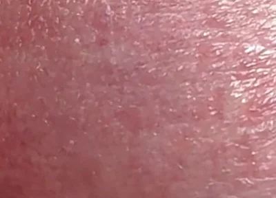 Sperm Close-up Front