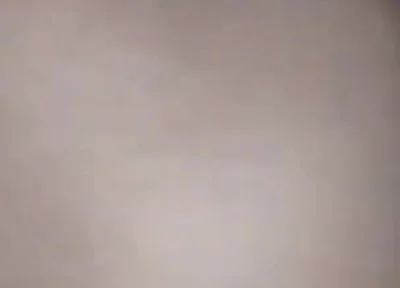 Destroying the Asshole on the Dick